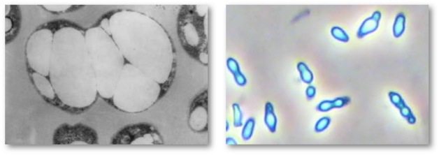 PHA granule SEM and Phase Contrast